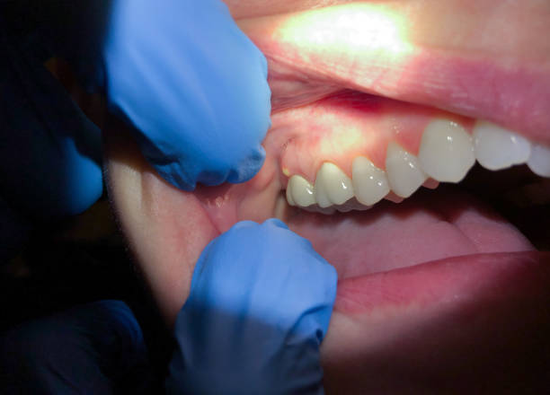 Best Emergency Dentist for Knocked-Out Tooth in Devine, TX
