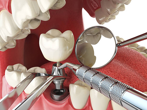 Best Broken or Cracked Tooth Emergency Dentist in Devine, TX